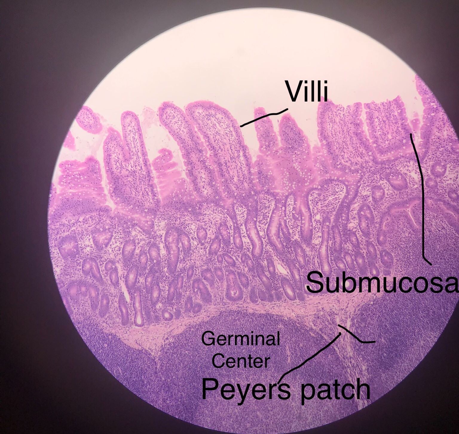 Peyer's Patch