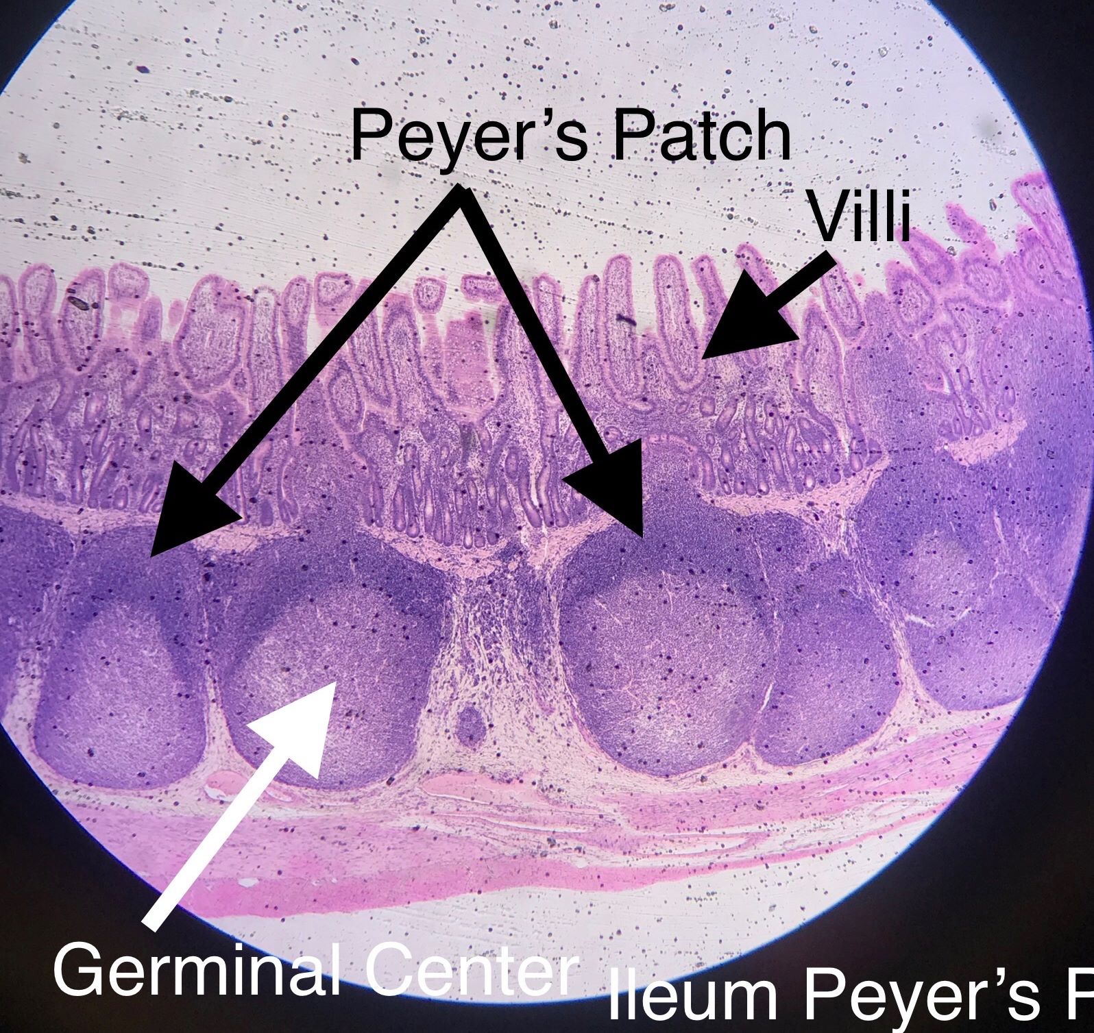 Peyer's Patch