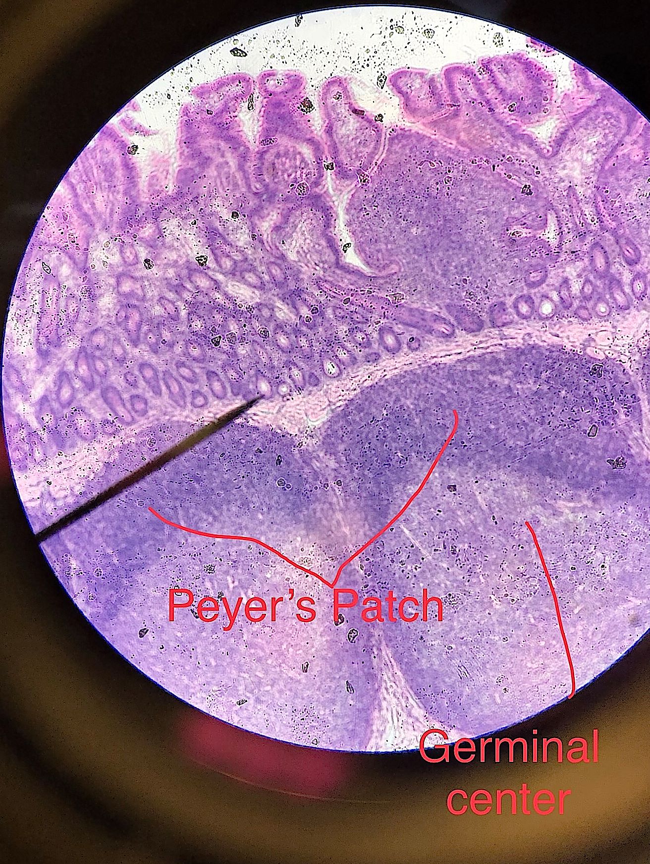 Peyer's Patch