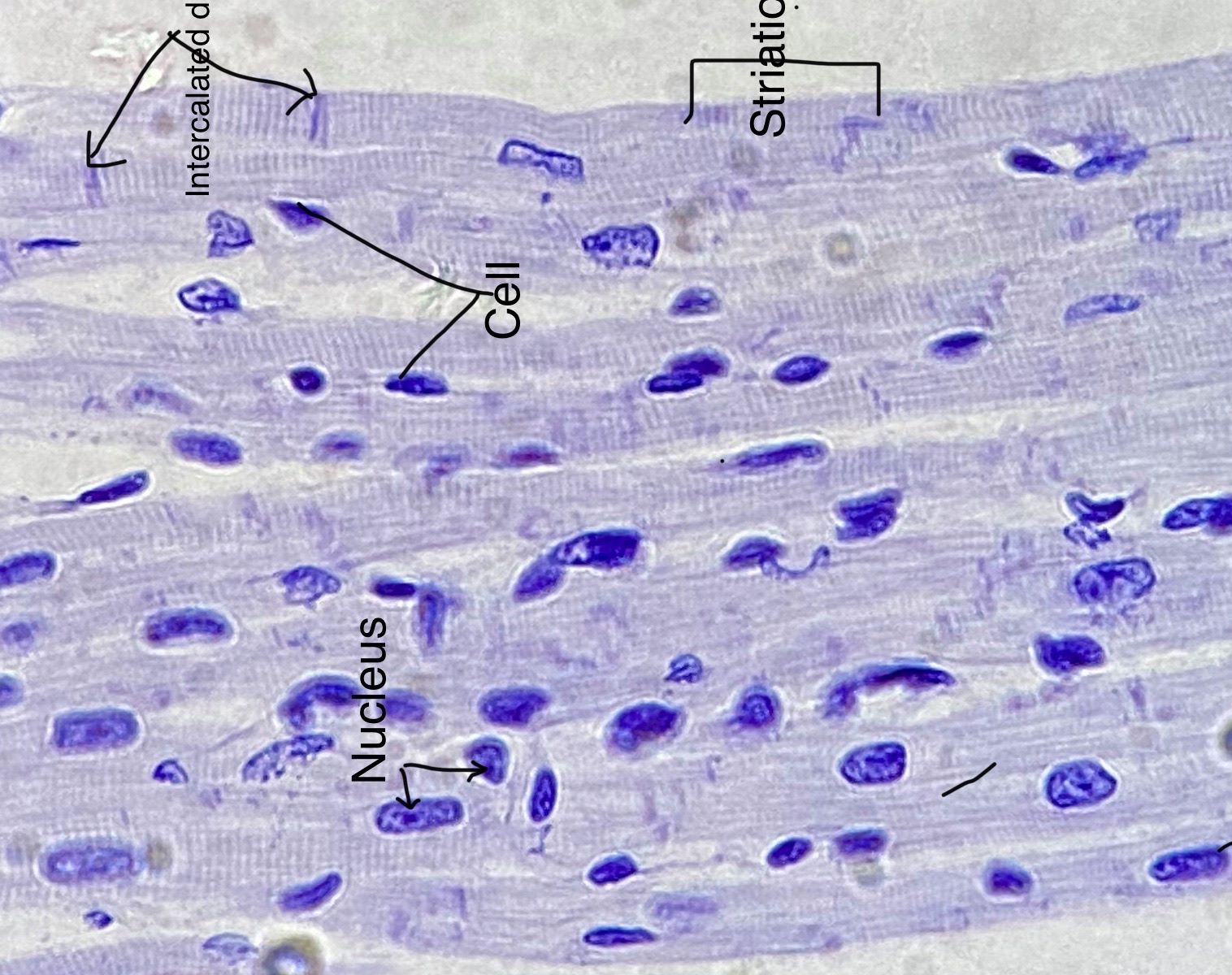 Cardiac Muscle