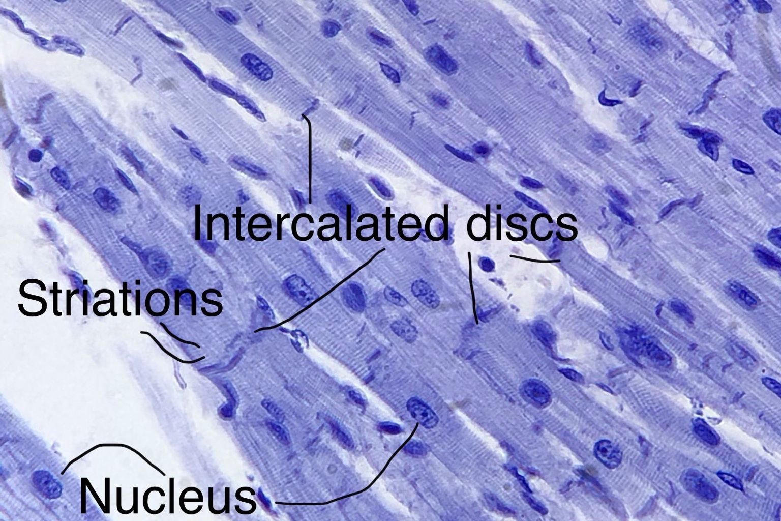 Cardiac Muscle