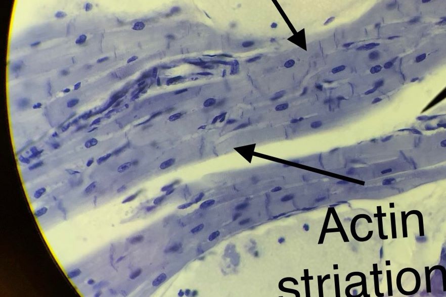 Cardiac Muscle