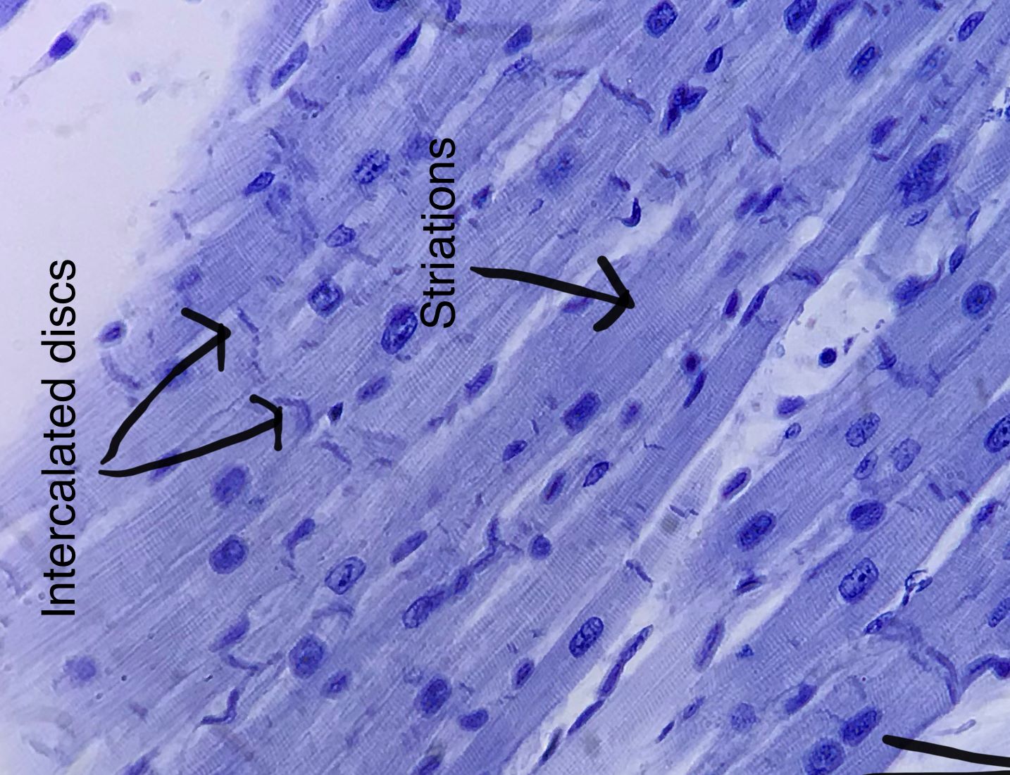 Cardiac Muscle