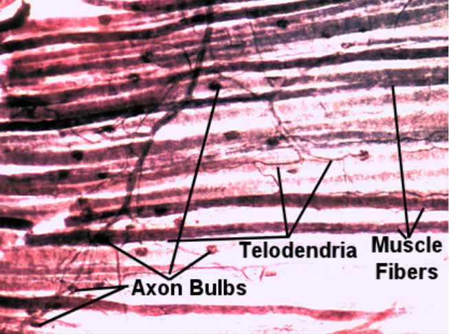 Motor End Plate  Labeled