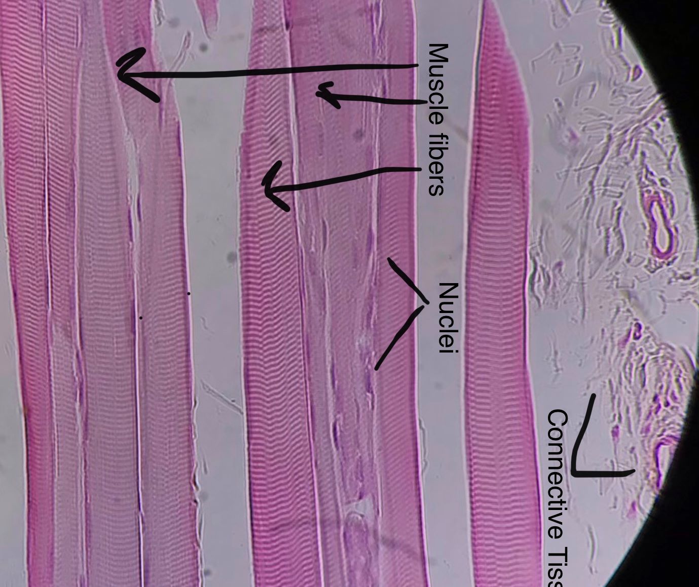 Skeletal Muscle