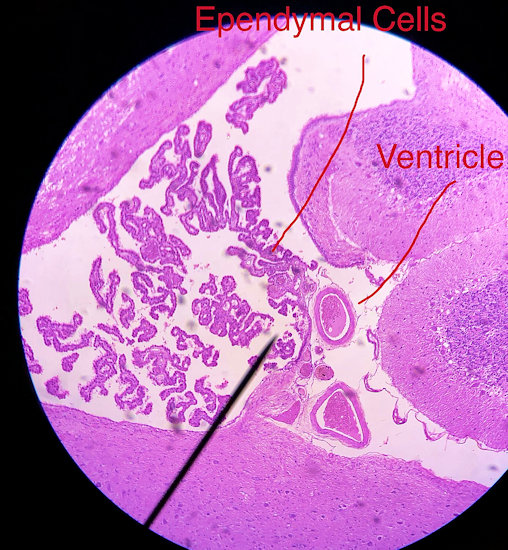 Pyramidal Neuron