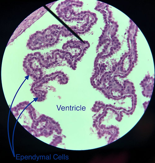 Pyramidal Neuron