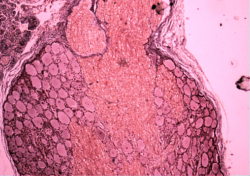 Pyramidal Neuron