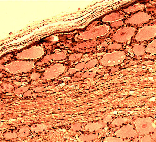 Pyramidal Neuron