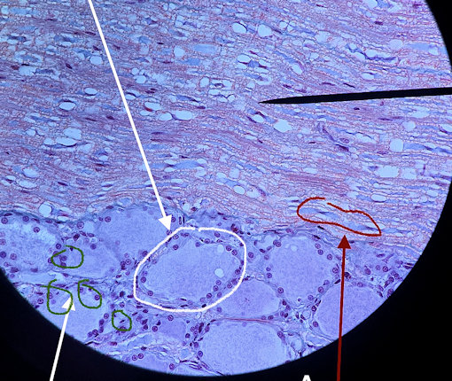 Pyramidal Neuron