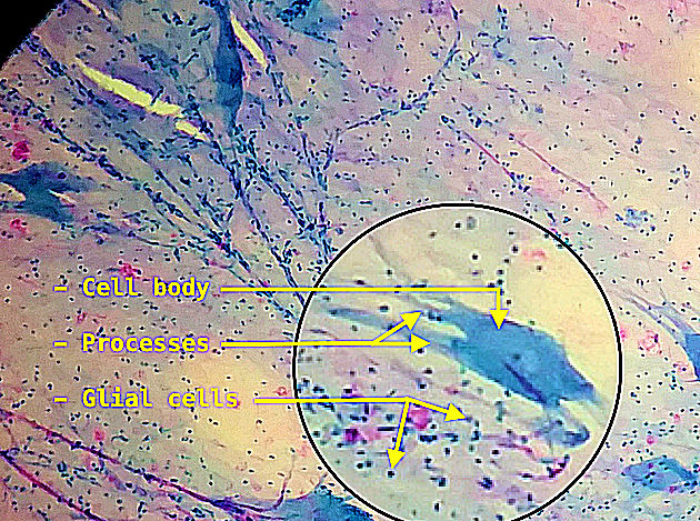 Multiipoloar Neuron