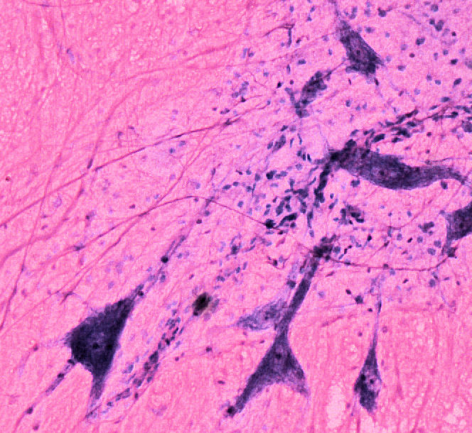 Multiipoloar Neuron