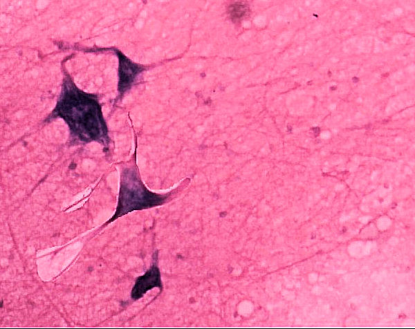 Multiipoloar Neuron