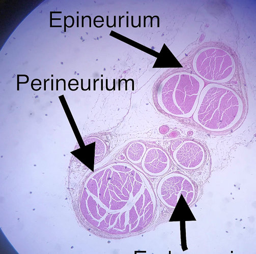 Pyramidal Neuron