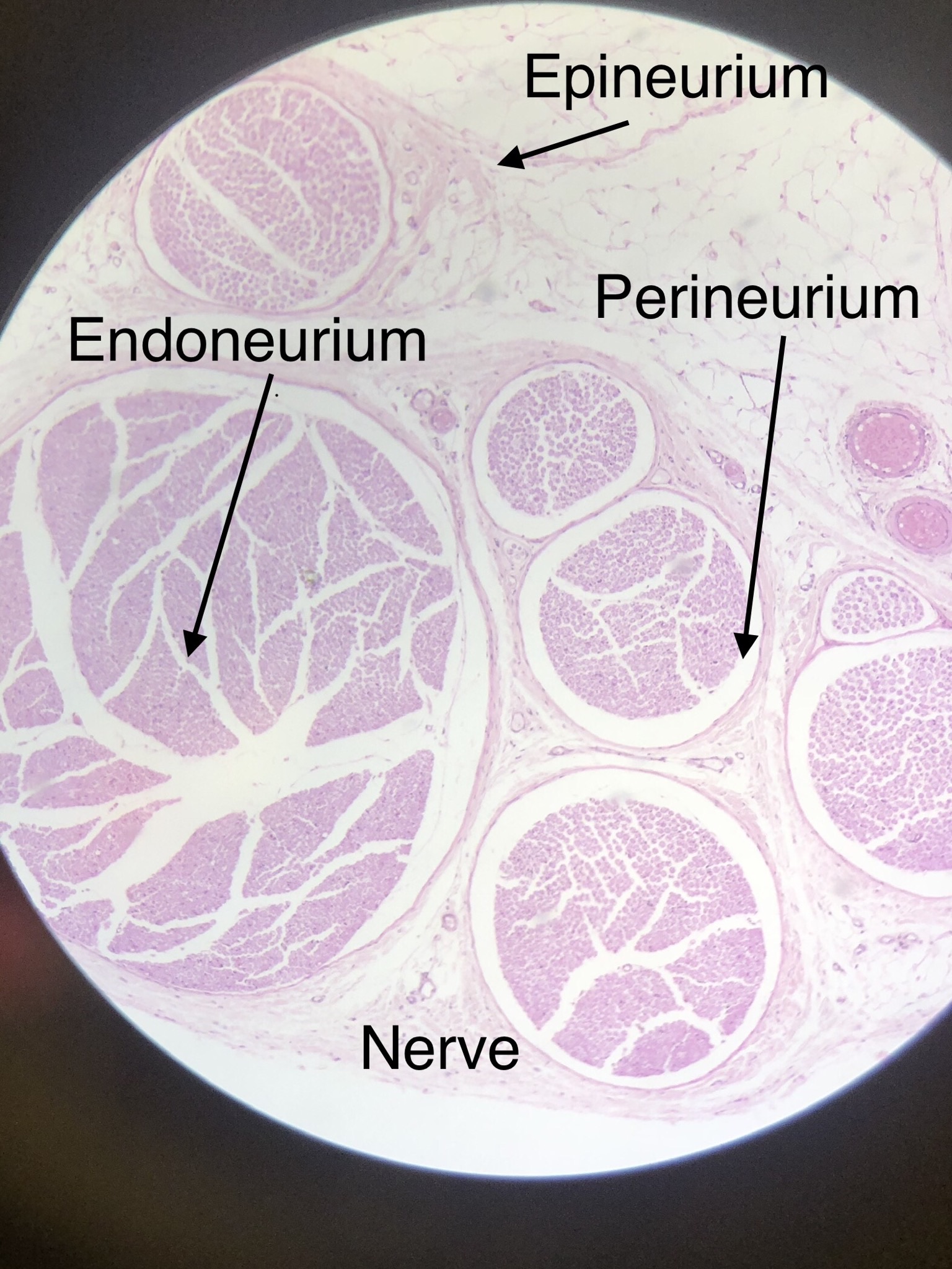 Pyramidal Neuron