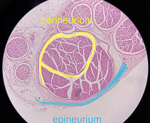 Pyramidal Neuron