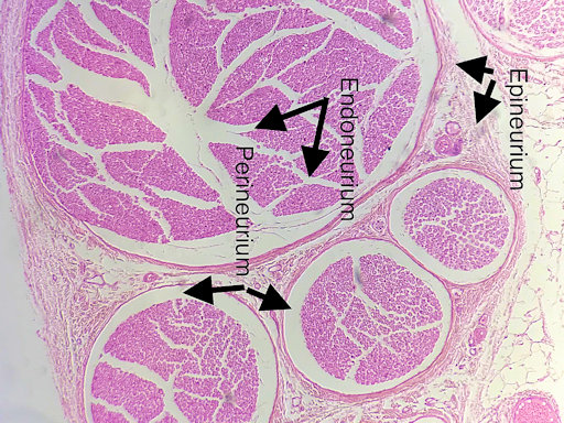 Pyramidal Neuron