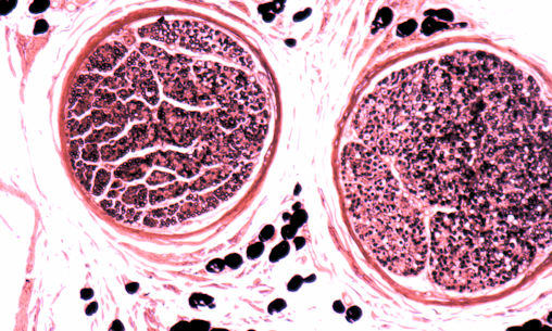 Pyramidal Neuron