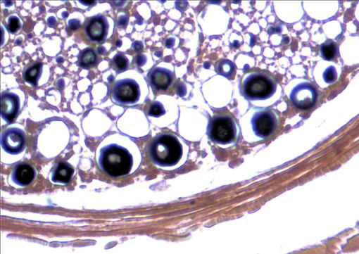 Pyramidal Neuron