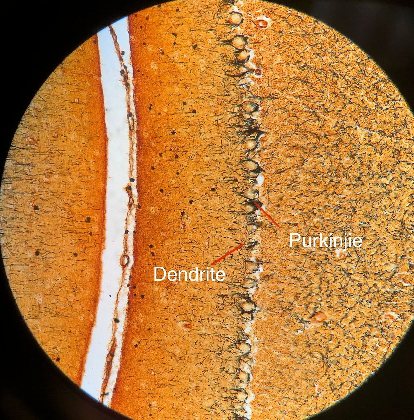 Pyramidal Neuron