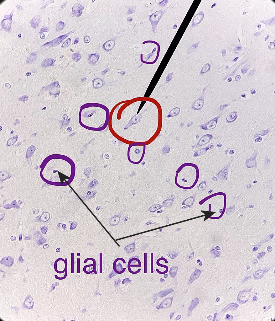 Pyramidal Neuron