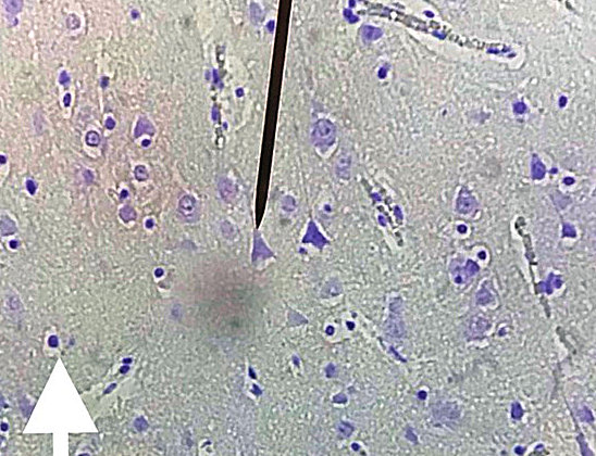 Pyramidal Neuron