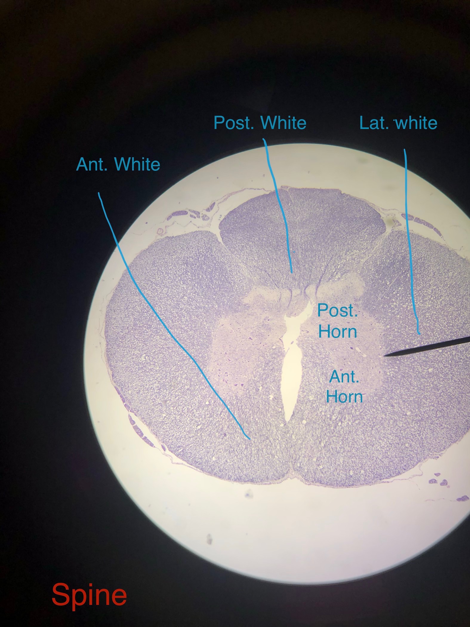 Pyramidal Neuron