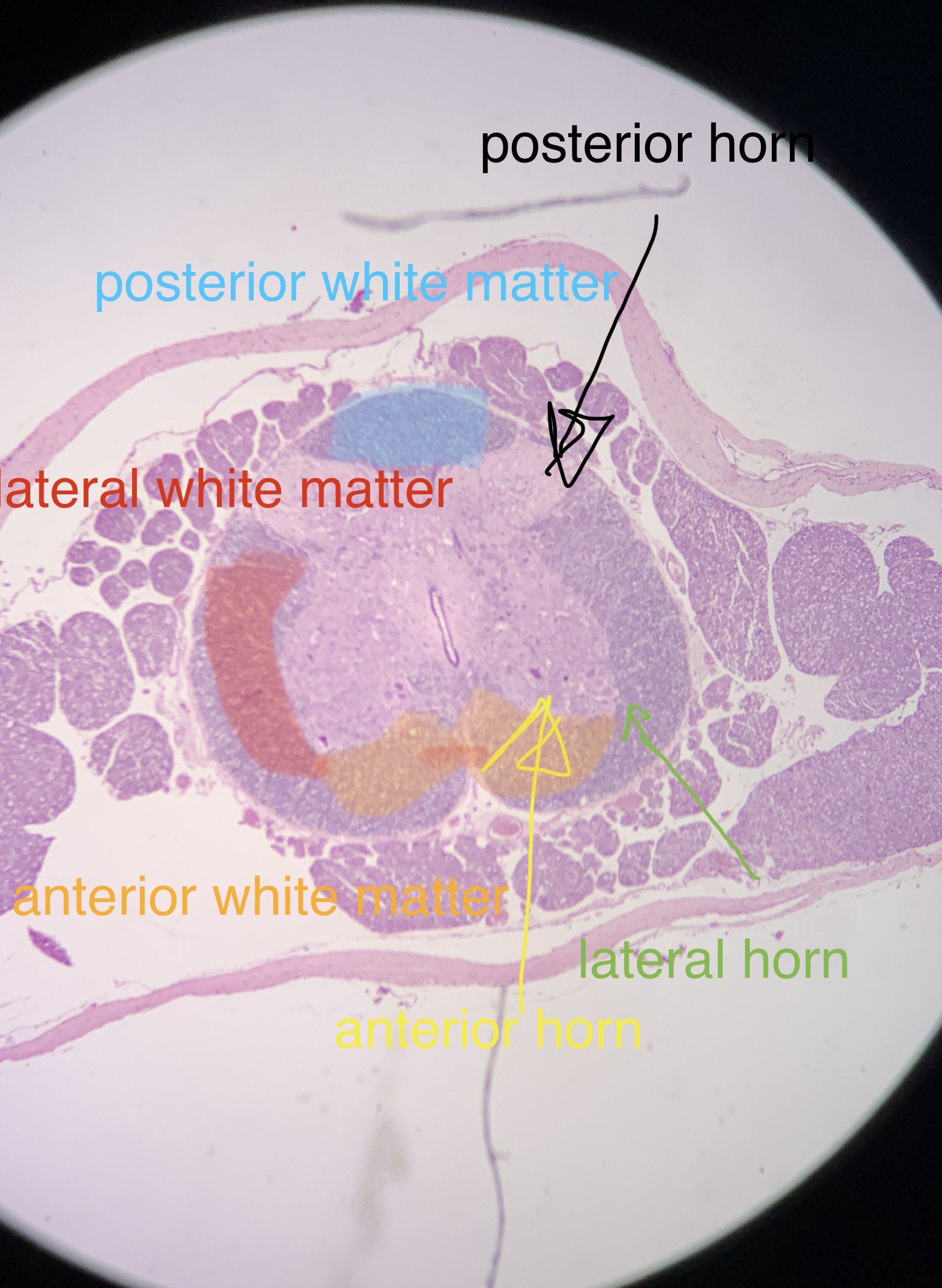 Pyramidal Neuron