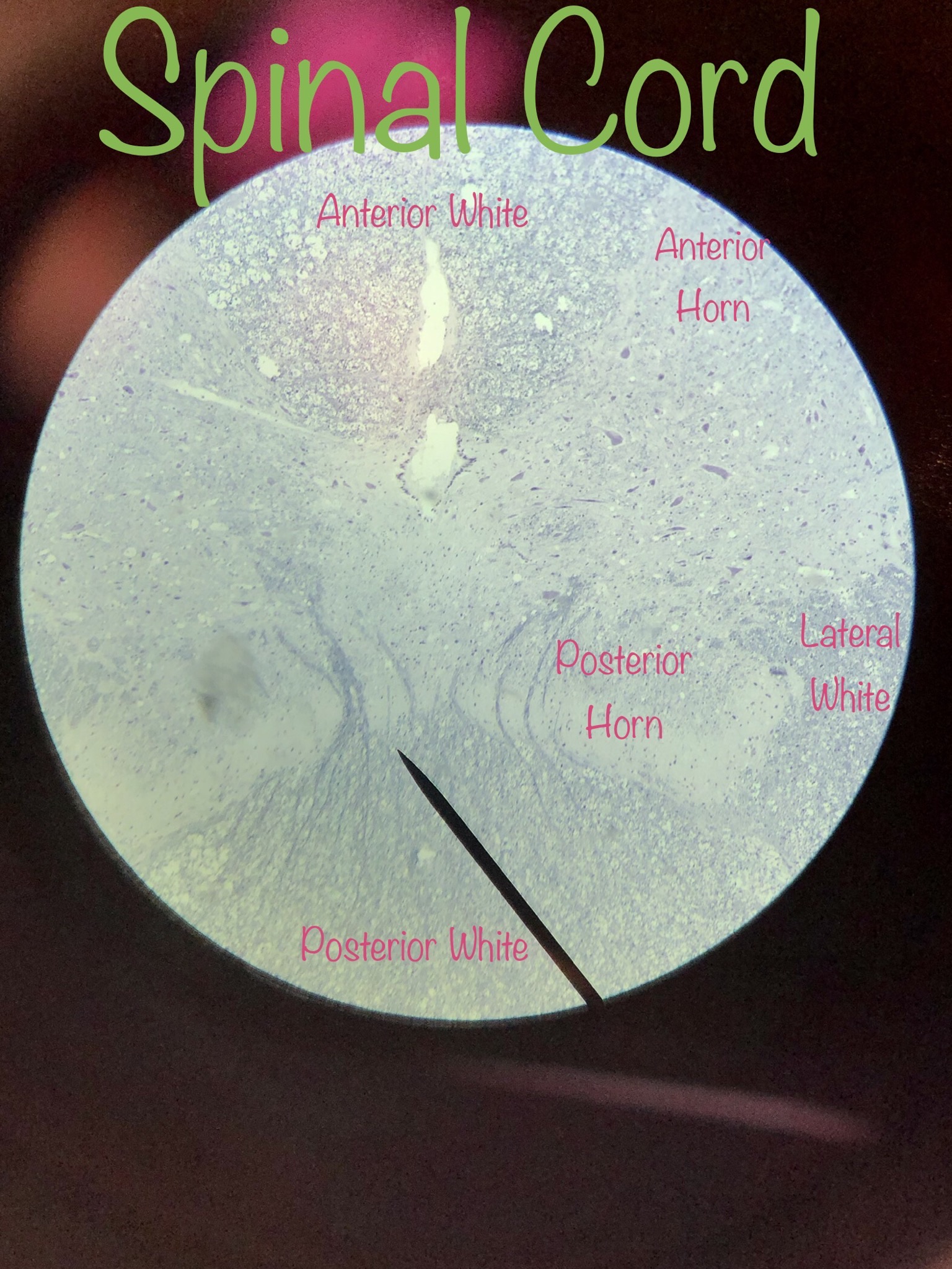 Pyramidal Neuron