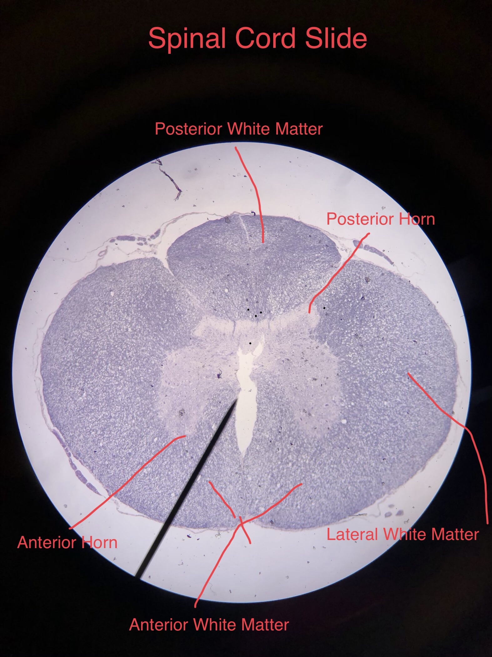 Pyramidal Neuron