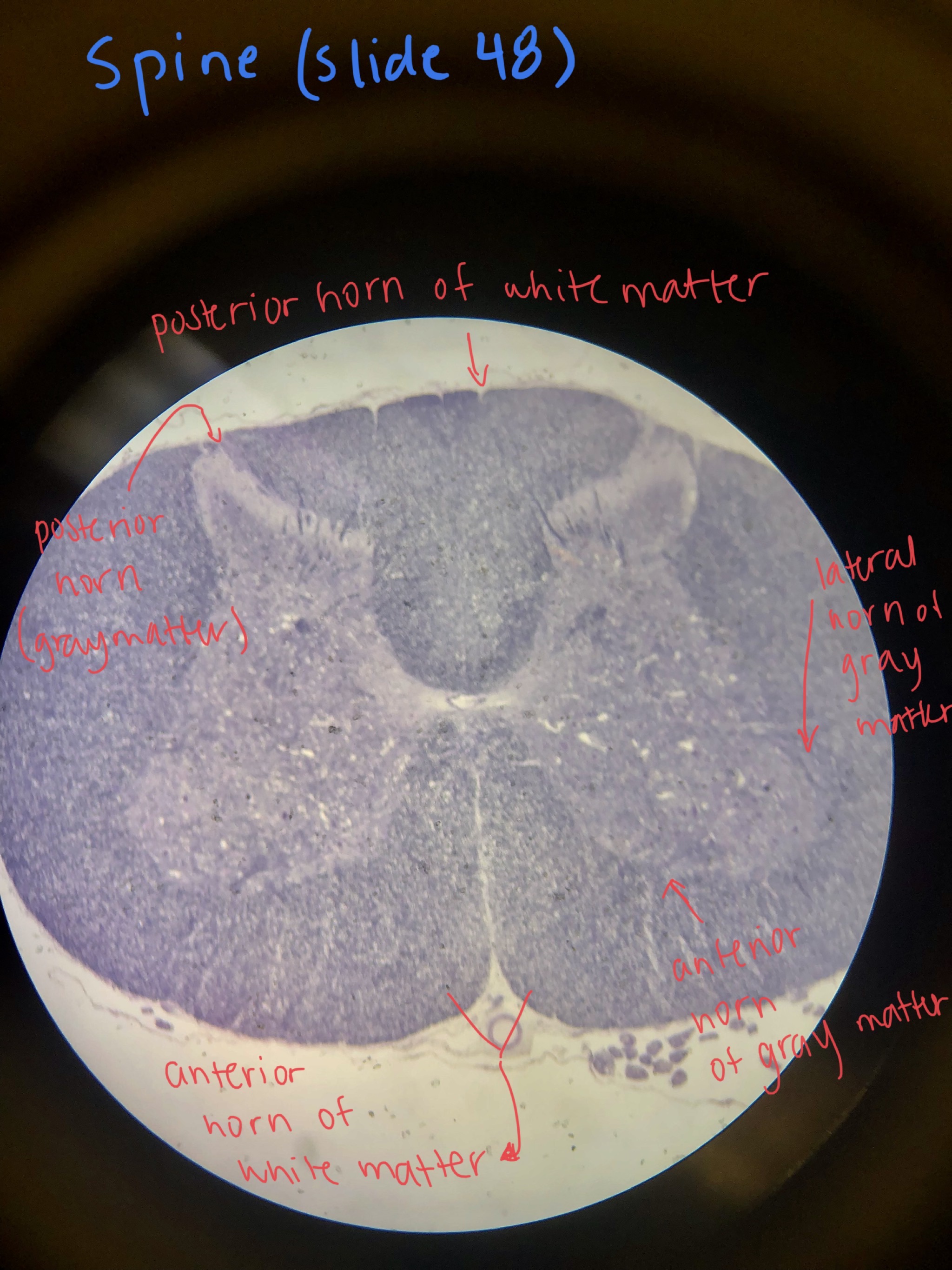 Pyramidal Neuron