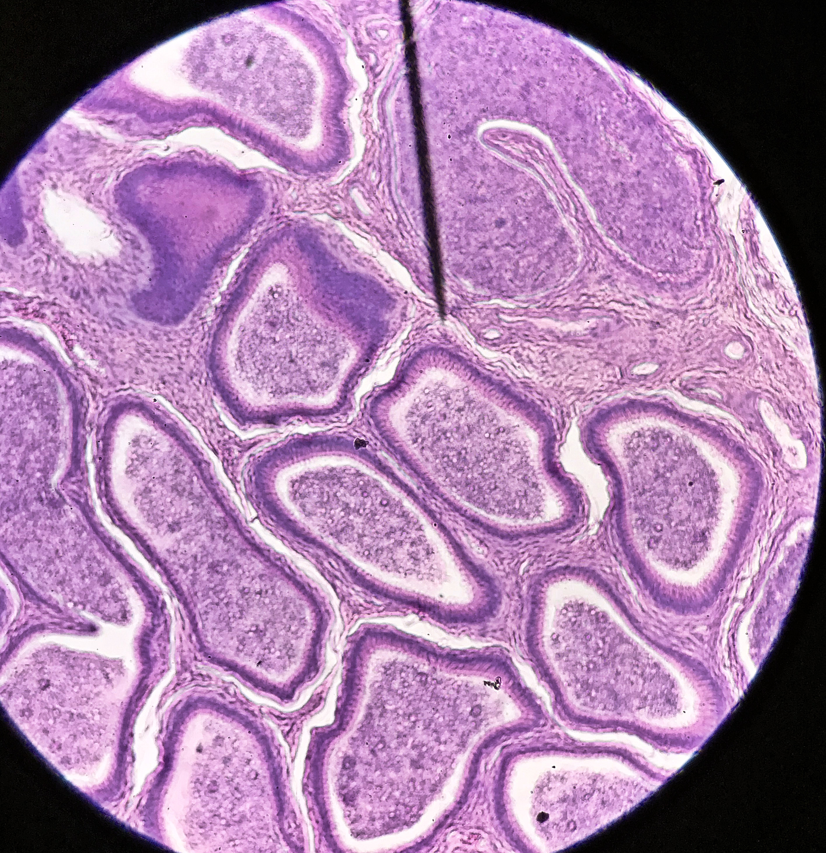 Epididymis