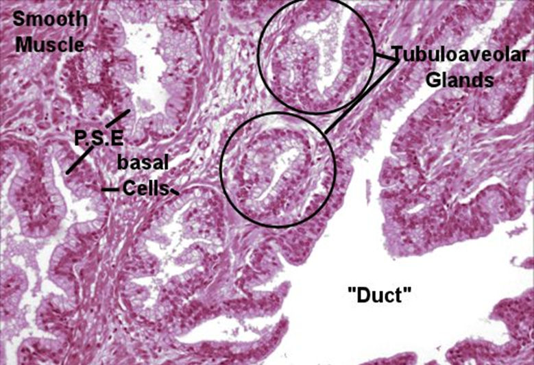 Prostate Labeled