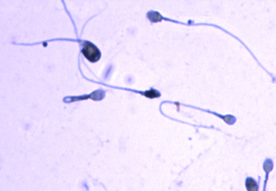 Sperm