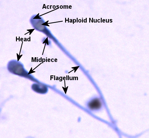 Sperm Labeled