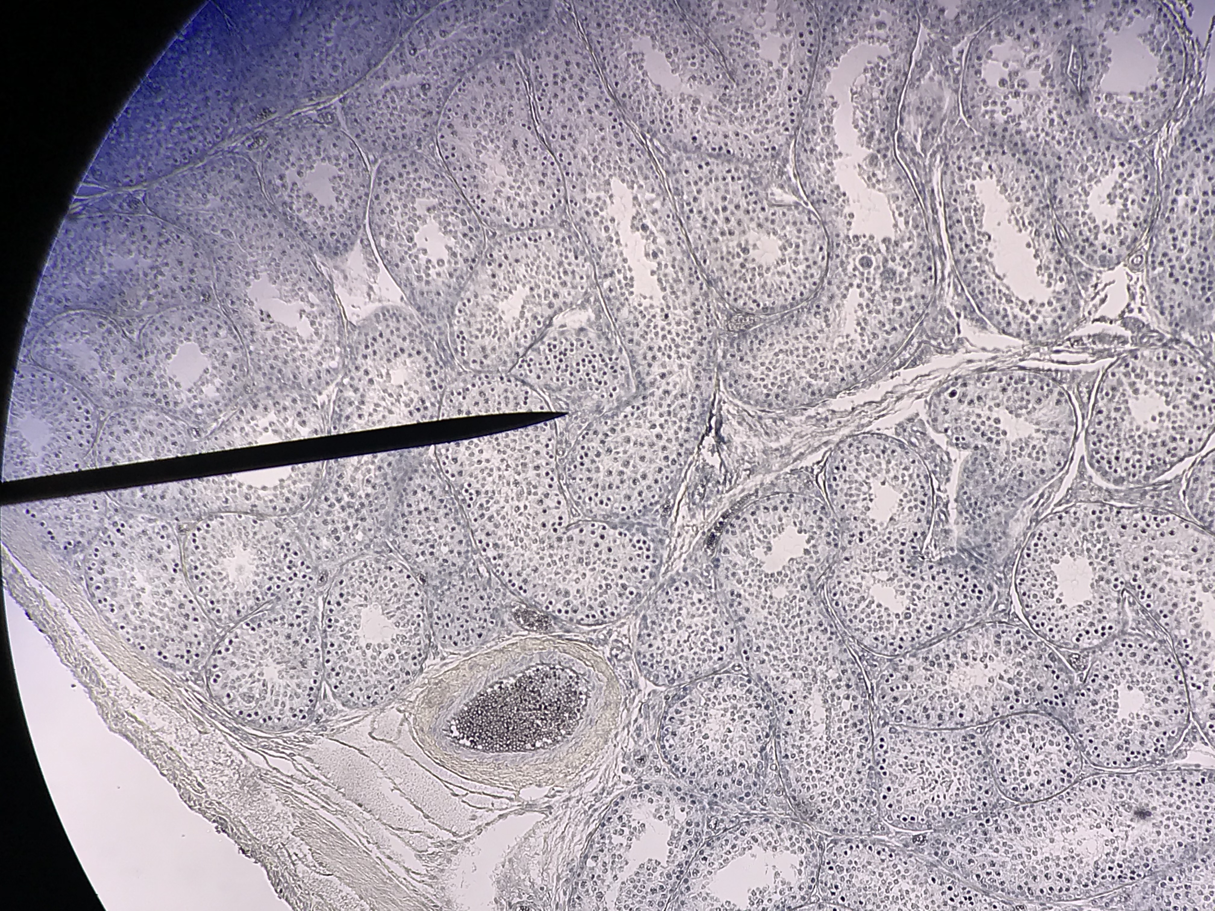 Seminiferous tubules