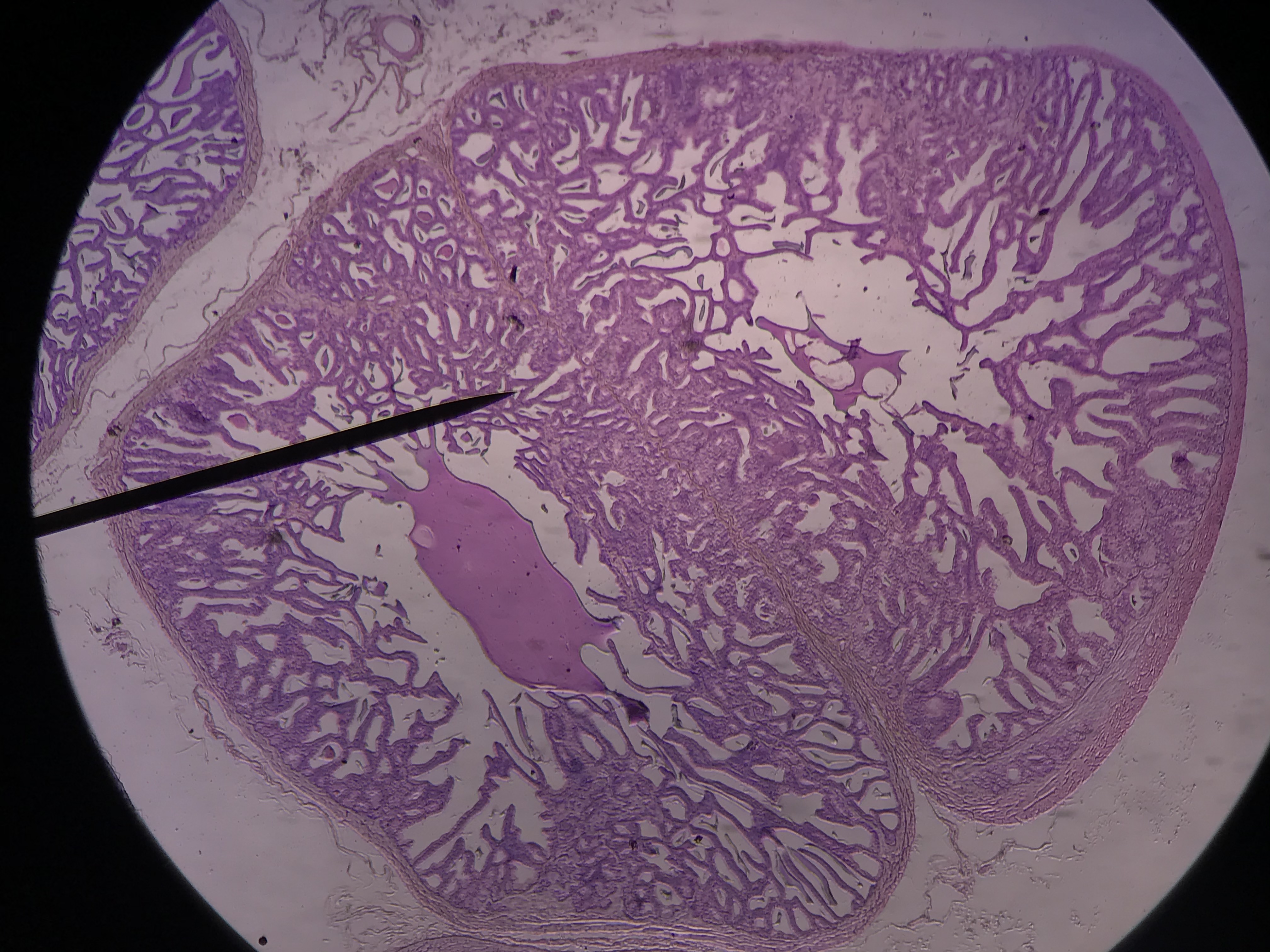 seminal vesicles