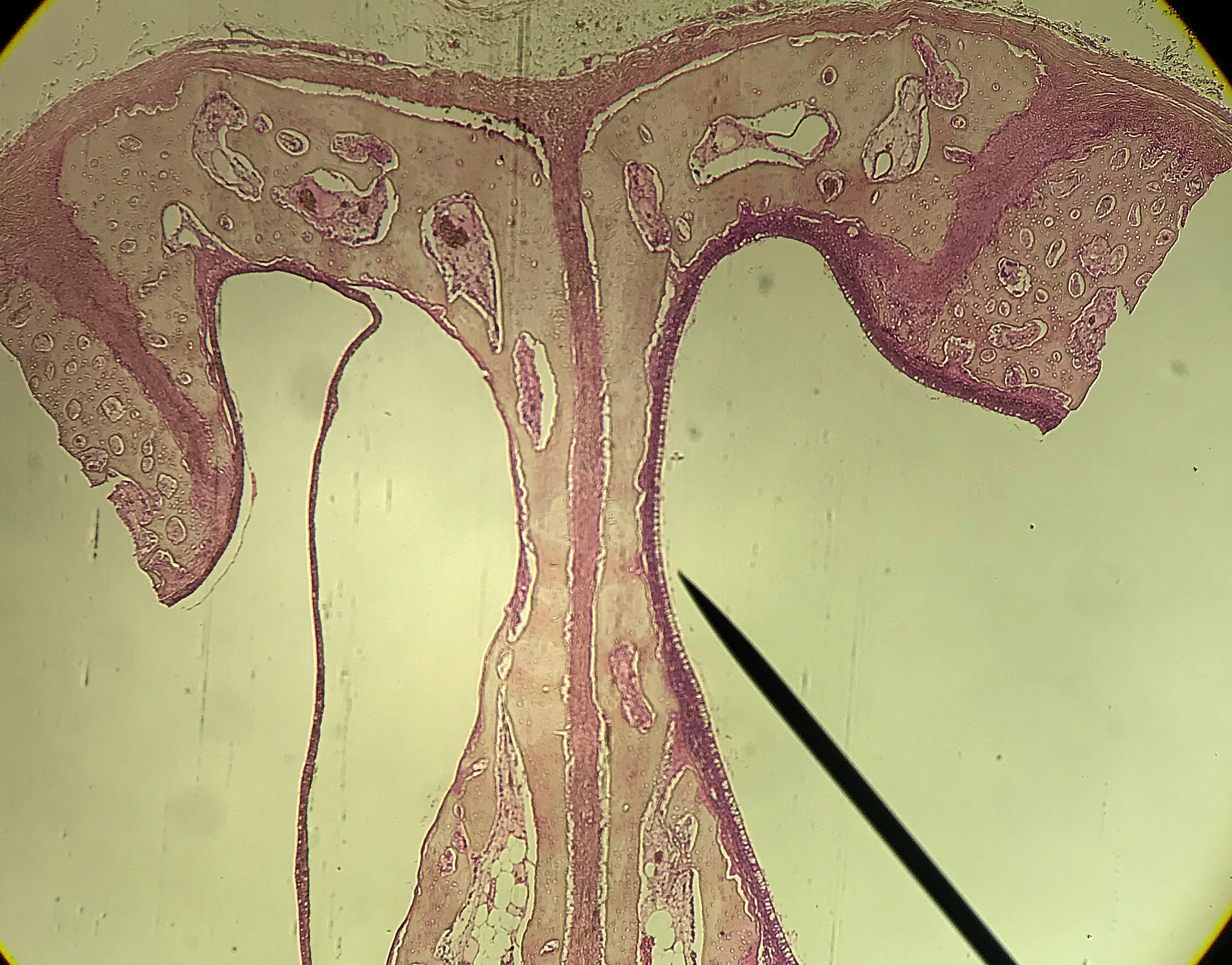 Nasal Epithelial