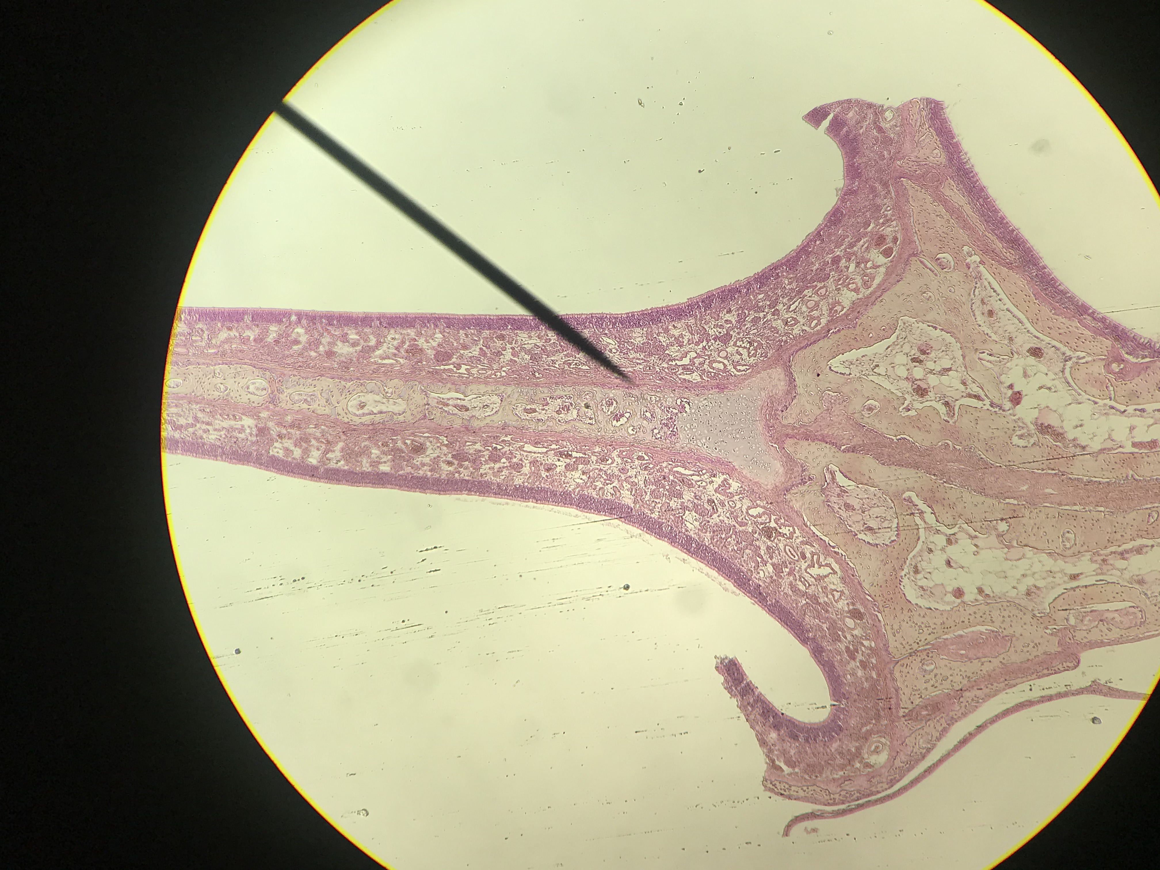 Nasal Epithelial