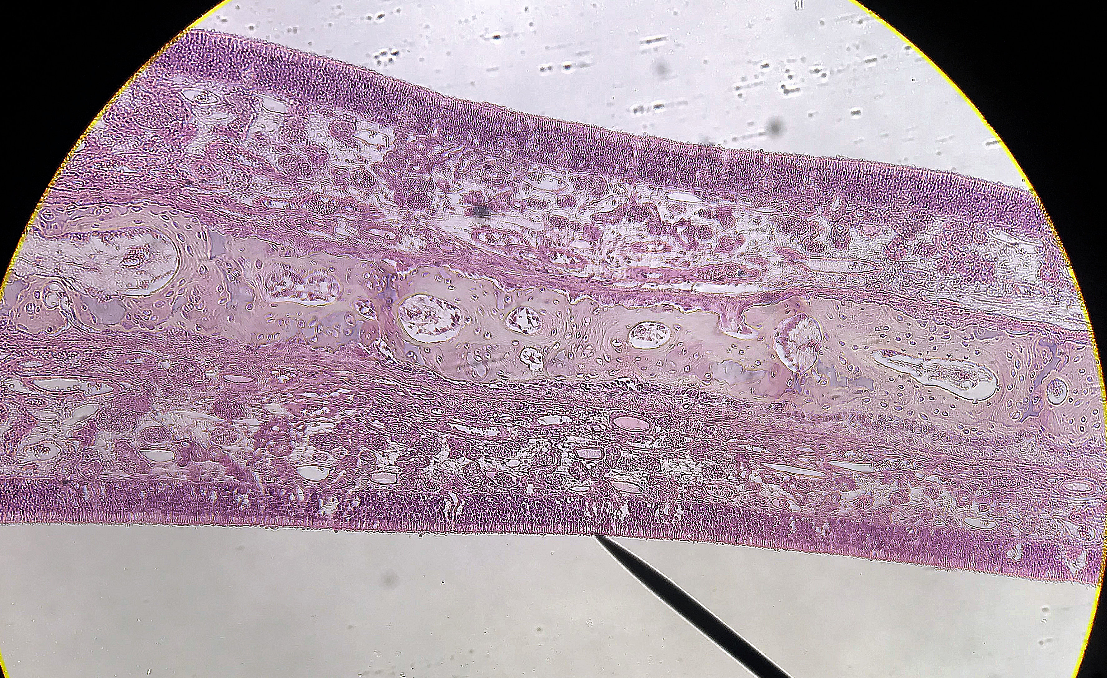 Nasal Epithelial