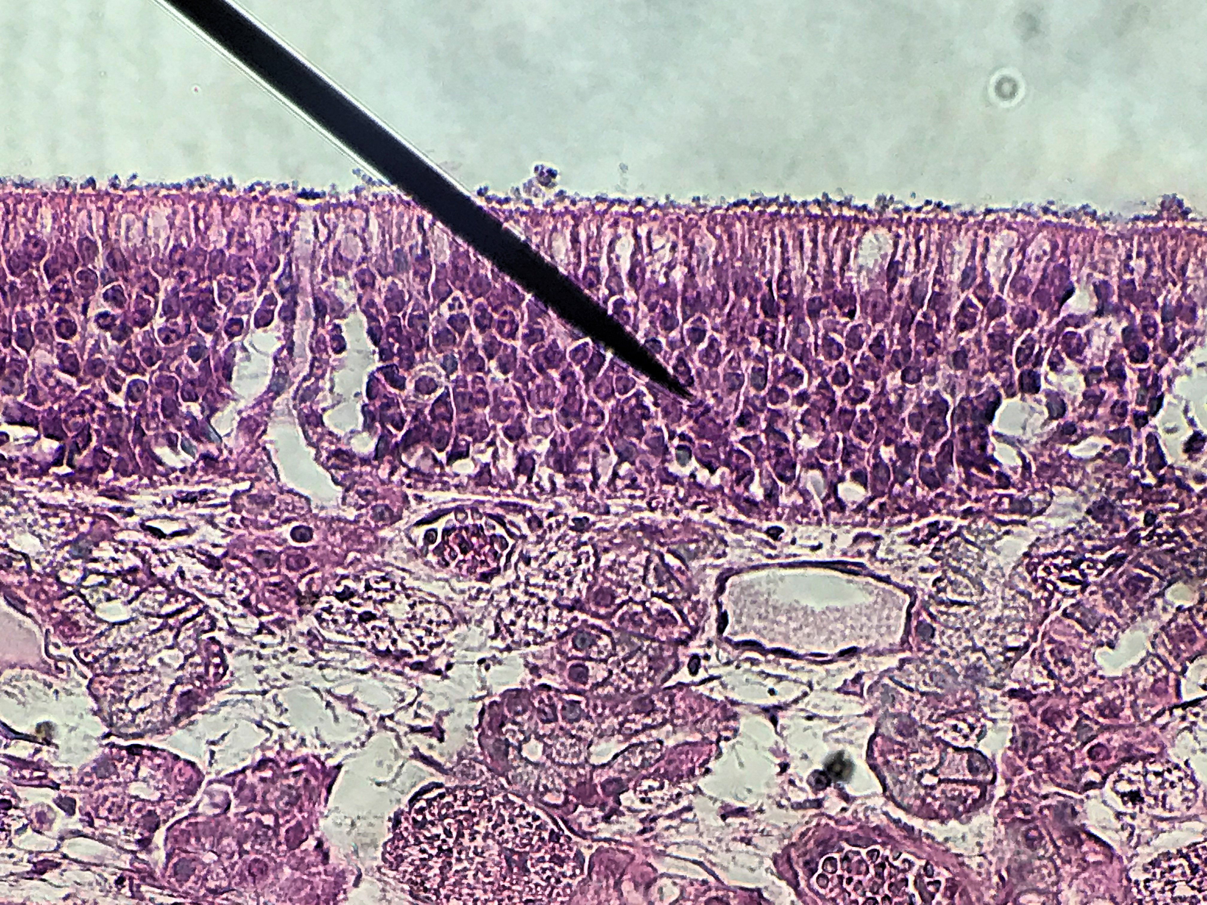 Nasal Epithelial