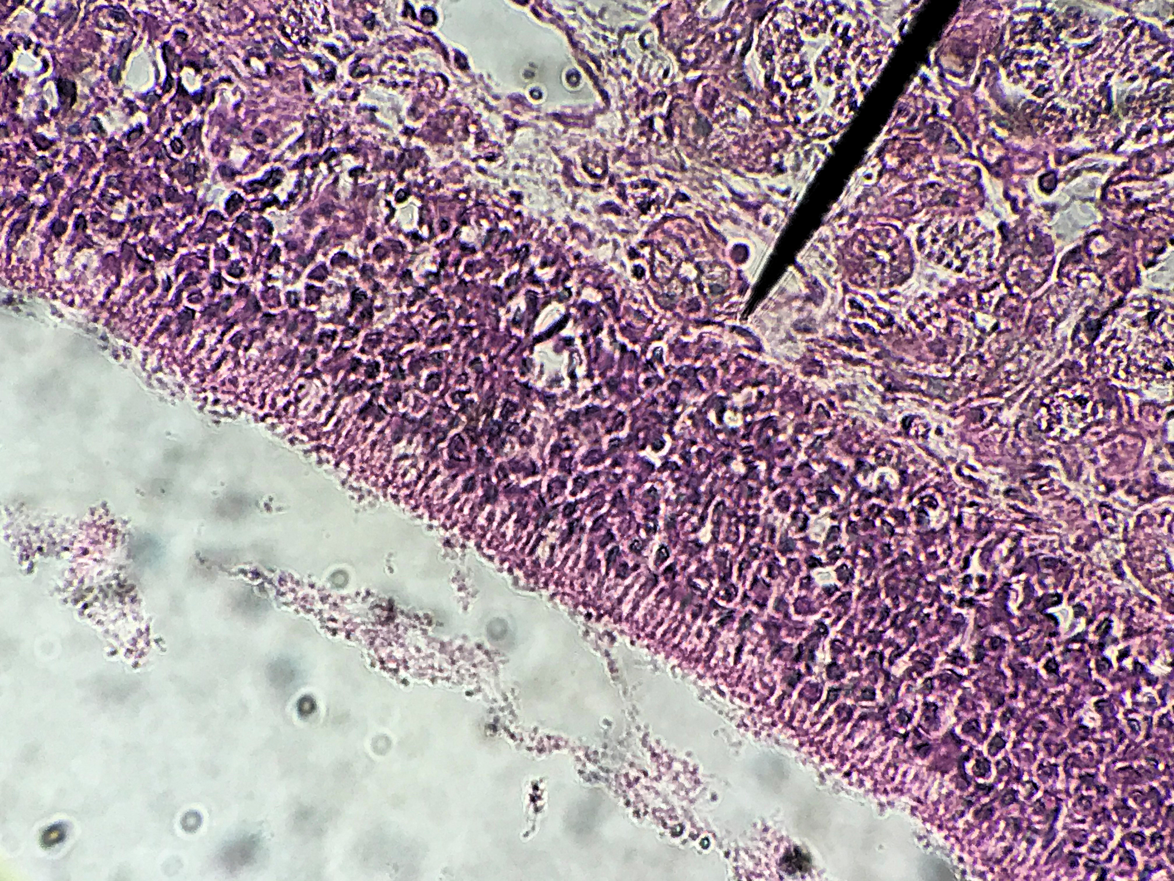 Nasal Epithelial