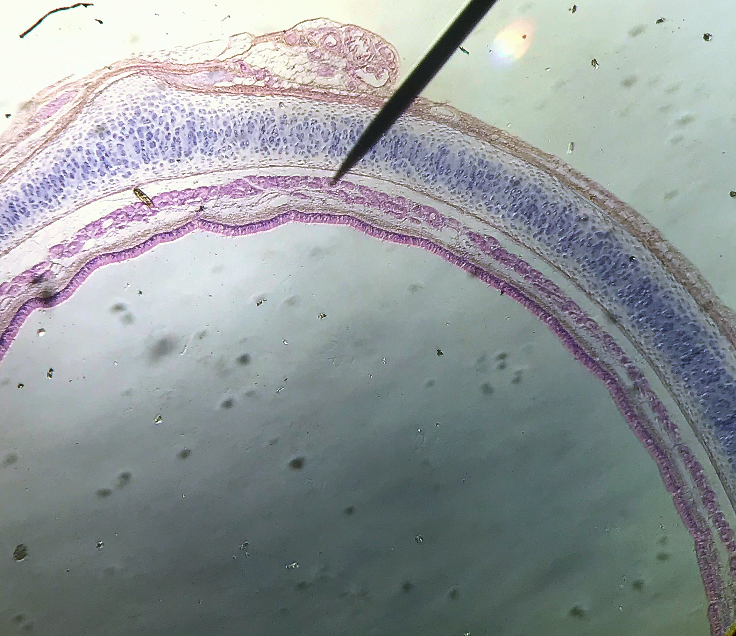 Tracheal