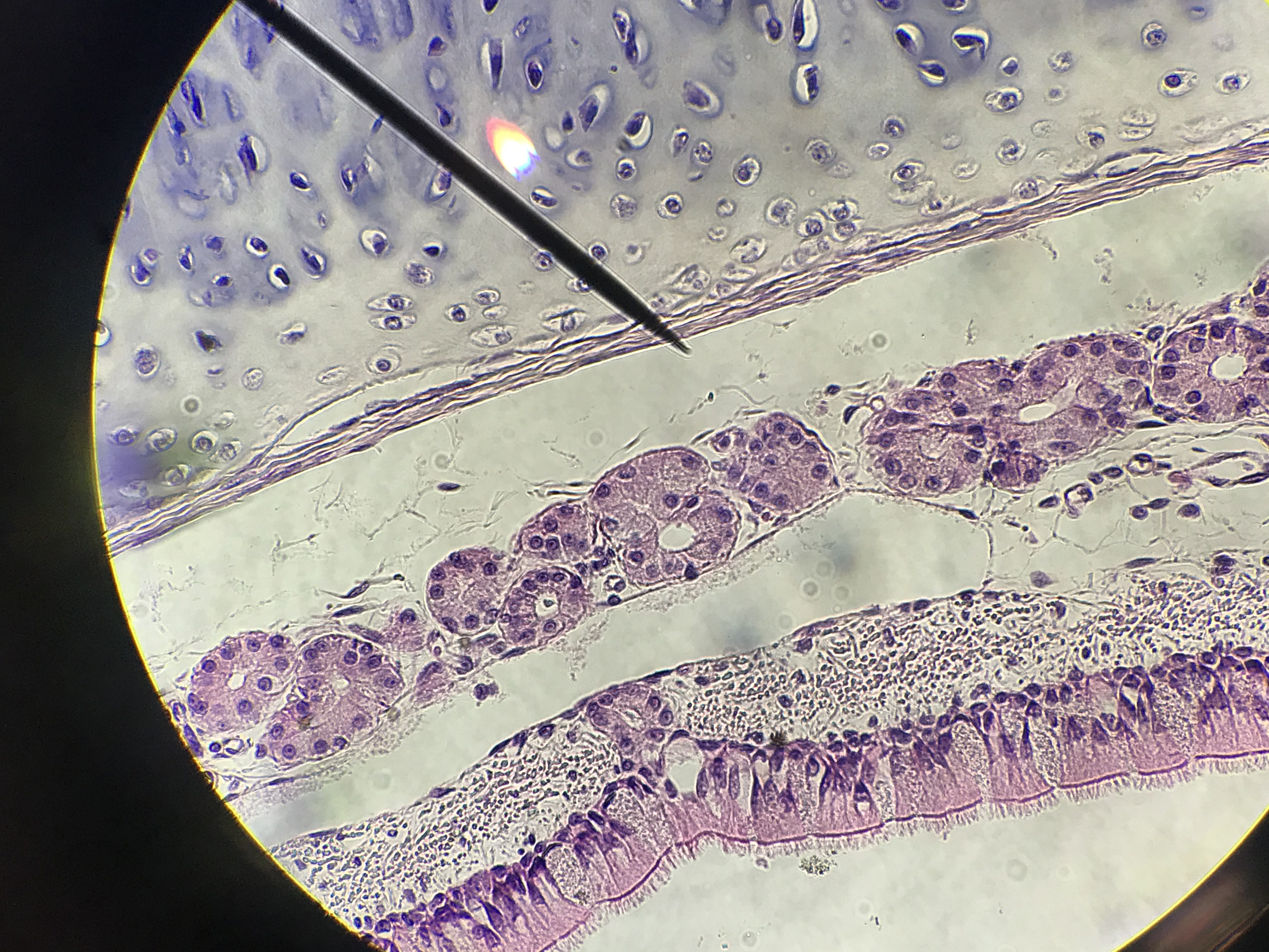 Tracheal