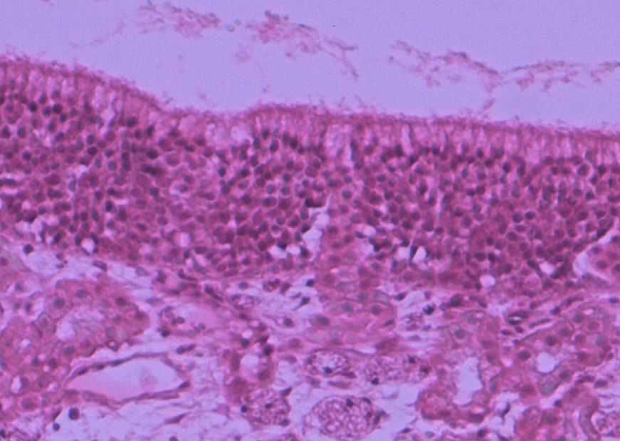 nasal epithelium