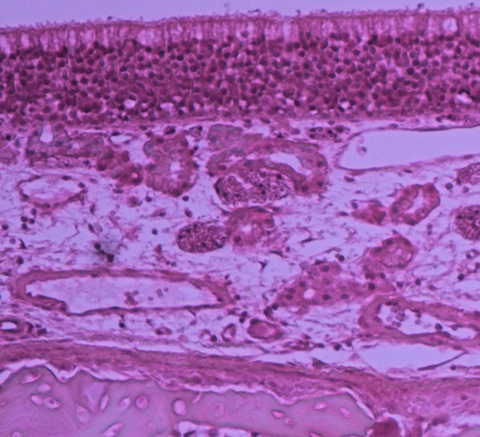 nasal epithelium