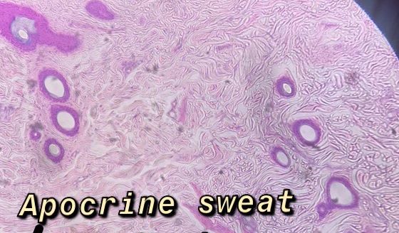 Apocrine Sweat