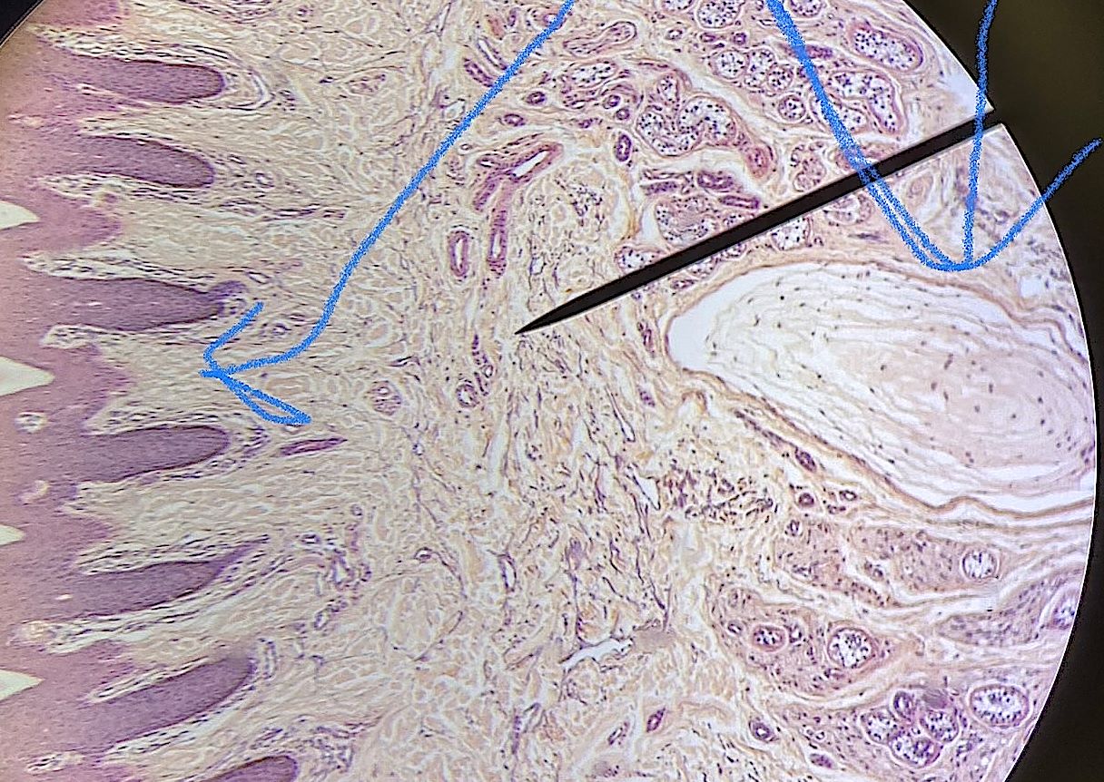 sensory corpuscles