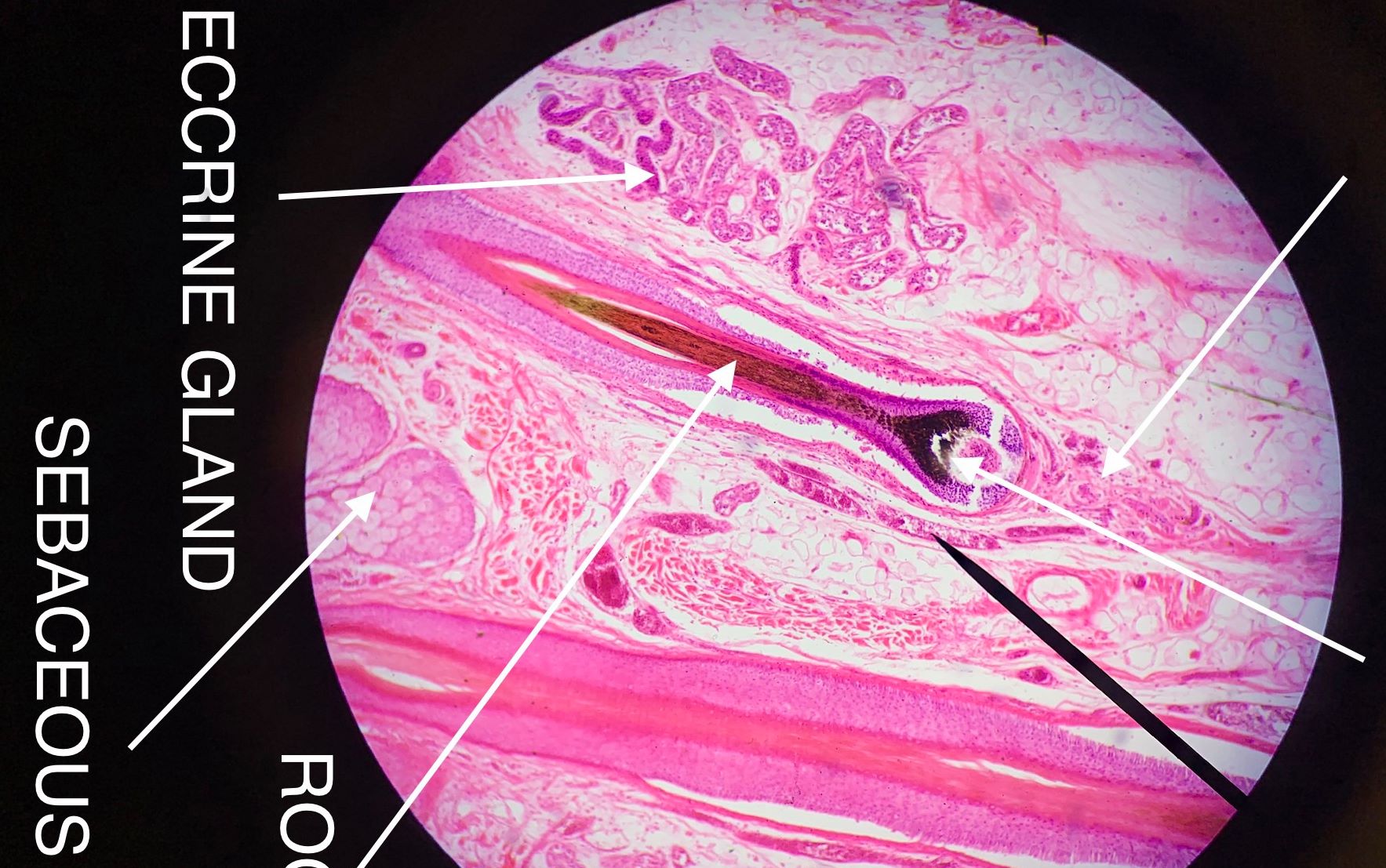 Eccrine gland