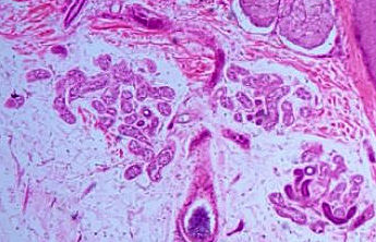 Eccrine Sweat Gland